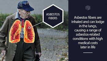 What types of medical costs do patients with rounded atelectasis incur? 