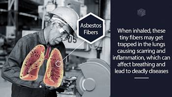 How can asbestosis be misdiagnosed as pneumonia?