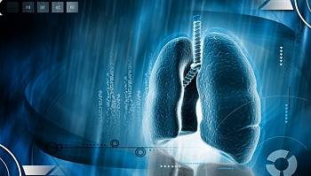 AI-based assessment tool used to track asbestos-related cancers