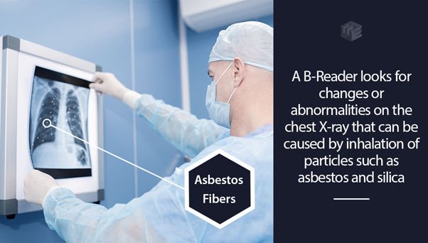 can asbestos cause heart problems