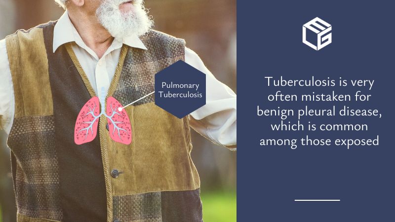 Tuberculosis associated with asbestos diseases