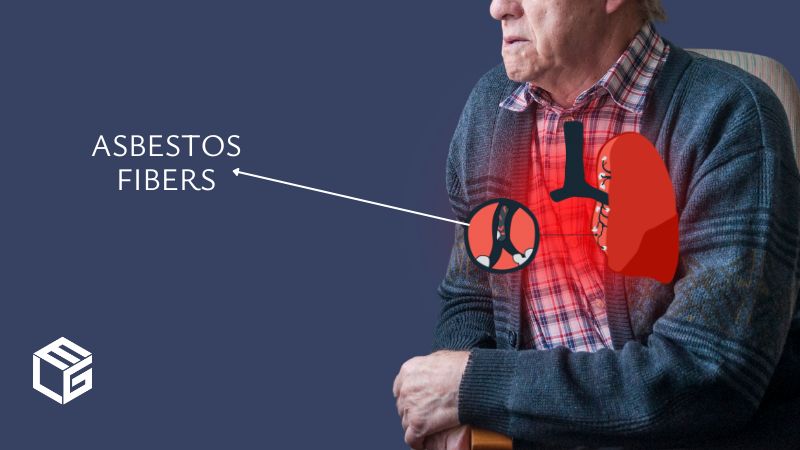 Asbestosis due to asbestos exposure video