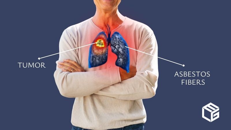 Asbestos bronchial cancer claims video