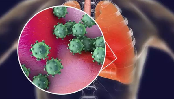 Here's what lung cancer patients need to know about the new coronavirus
