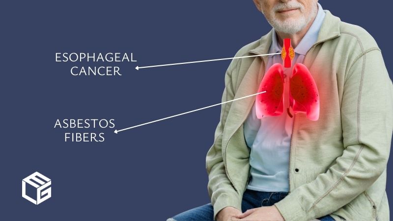 Asbestos esophageal cancer claims video