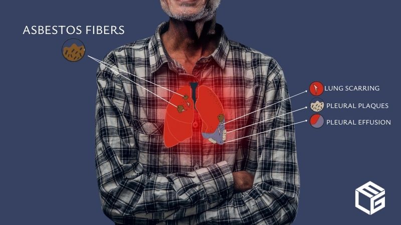 Asbestos lung cancer claims video