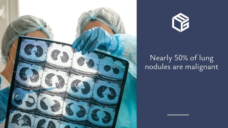 Lung nodules due to asbestos exposure video