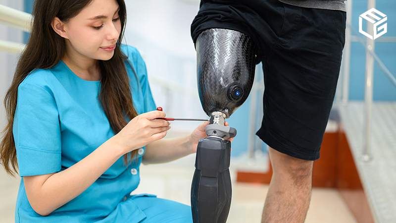 FELA claims: Amputation due to railroad injury