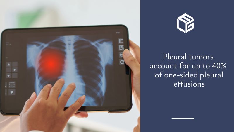 Pleural effusion due to asbestos exposure video