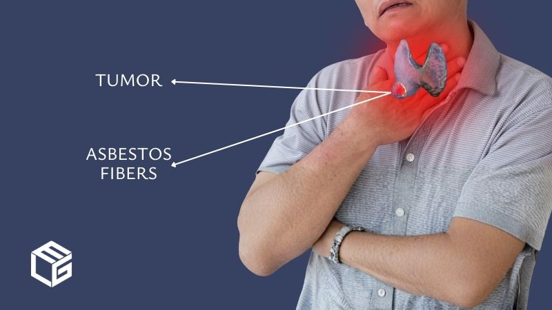 Asbestos throat cancer claims video