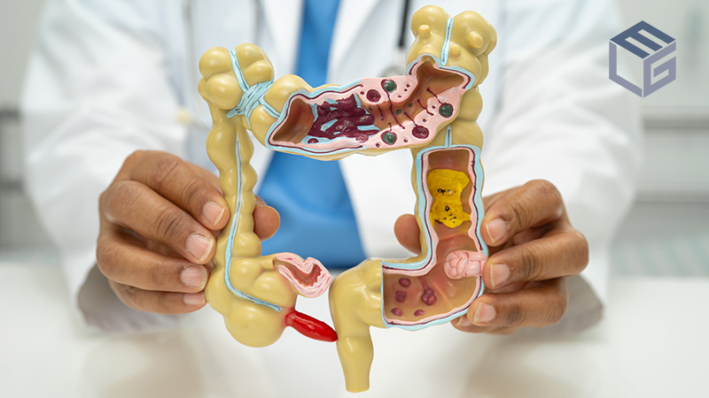 PFOA found in firefighting foam linked to ulcerative colitis