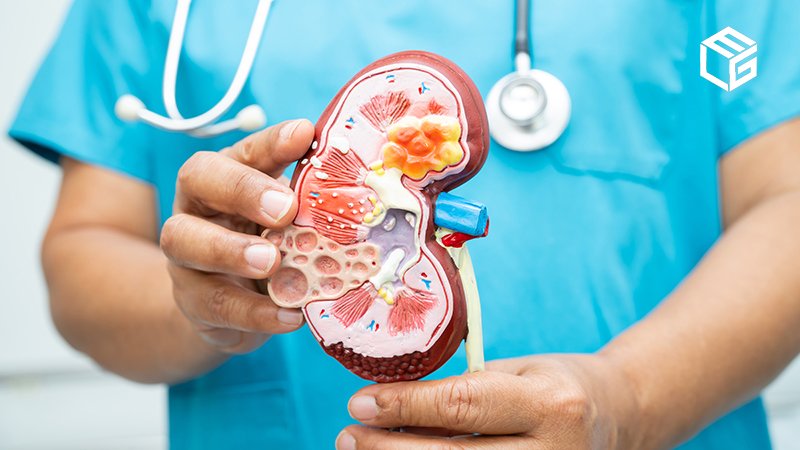 PACT Act: Veterans with kidney cancer eligible for VA benefits, disability compensation