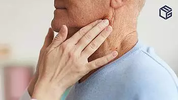 Thyroid cancer makes you eligible to file an AFFF claim