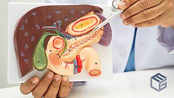 PFAS chemicals PFHxS and PFUnDA linked to pancreatic cancer